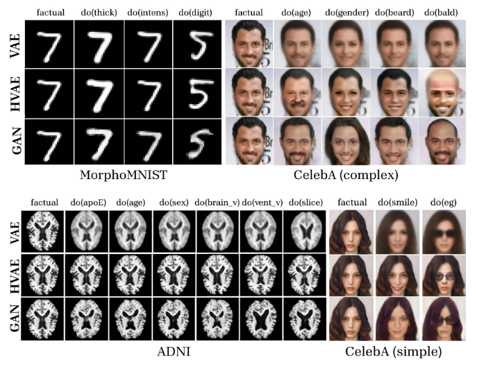 Figure 5: Qualitative evaluation of effectiveness for all datasets/graphs. From left to right across
    datasets: the leftmost image is the factual one and then each column shows the causal counterfactual
    image after intervening on a single attribute. v: volume; vent: ventricle; eg: eyeglasses.